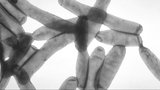 Report: Legionnaires' Disease cases up 143% in SE Michigan